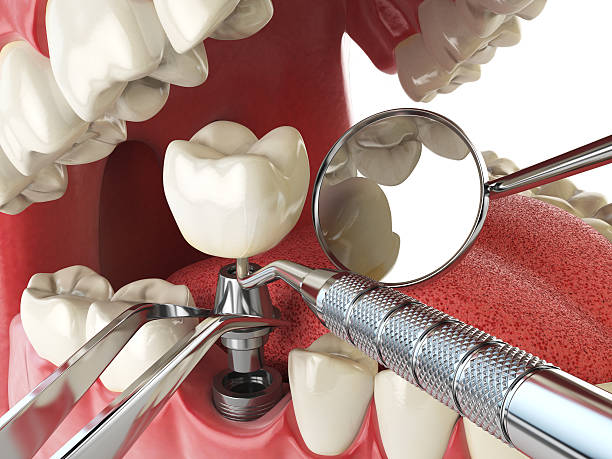 Best Cracked Tooth Emergency Dentist  in Magalia, CA